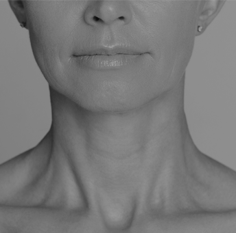 Treatment - Harrow On The Hill Dental and Facial Aesthetics