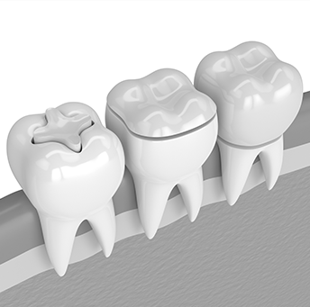 Treatment - Harrow On The Hill Dental and Facial Aesthetics