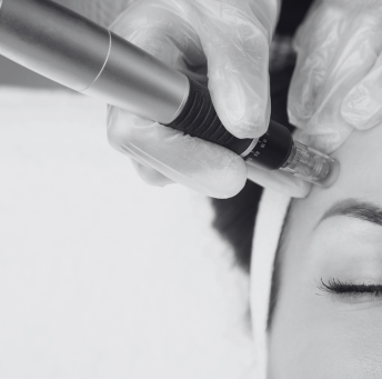 Treatment - Harrow On The Hill Dental and Facial Aesthetics