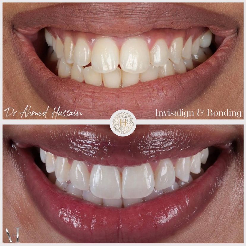 Smile-gallery-harrow