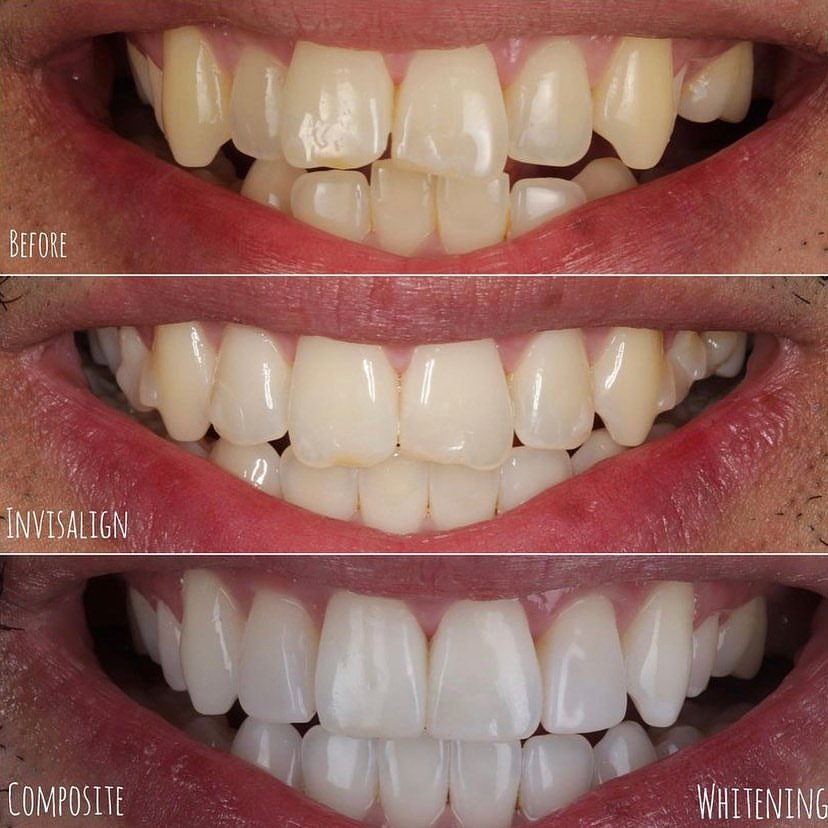 Smile-gallery-harrow