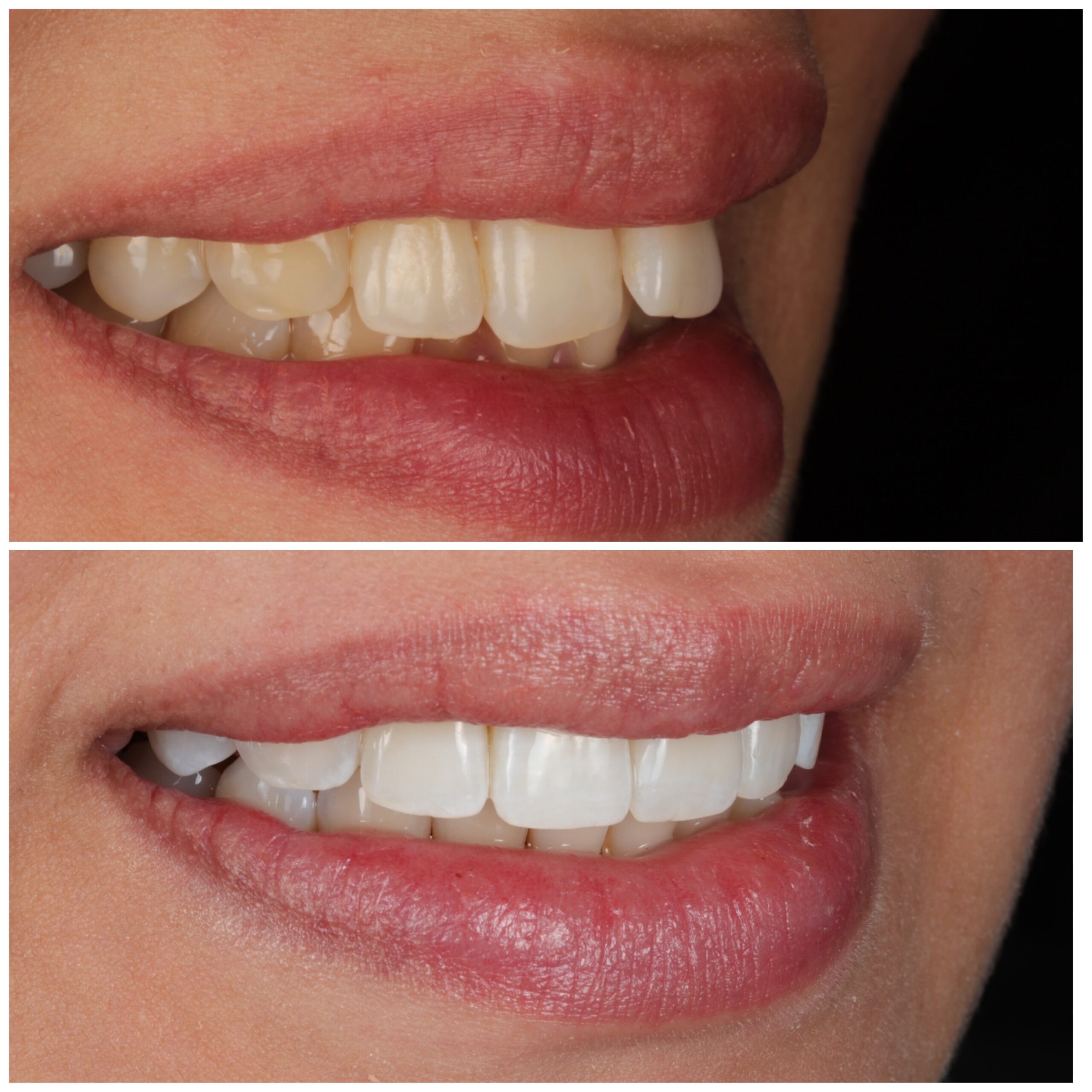 Smile-gallery-harrow