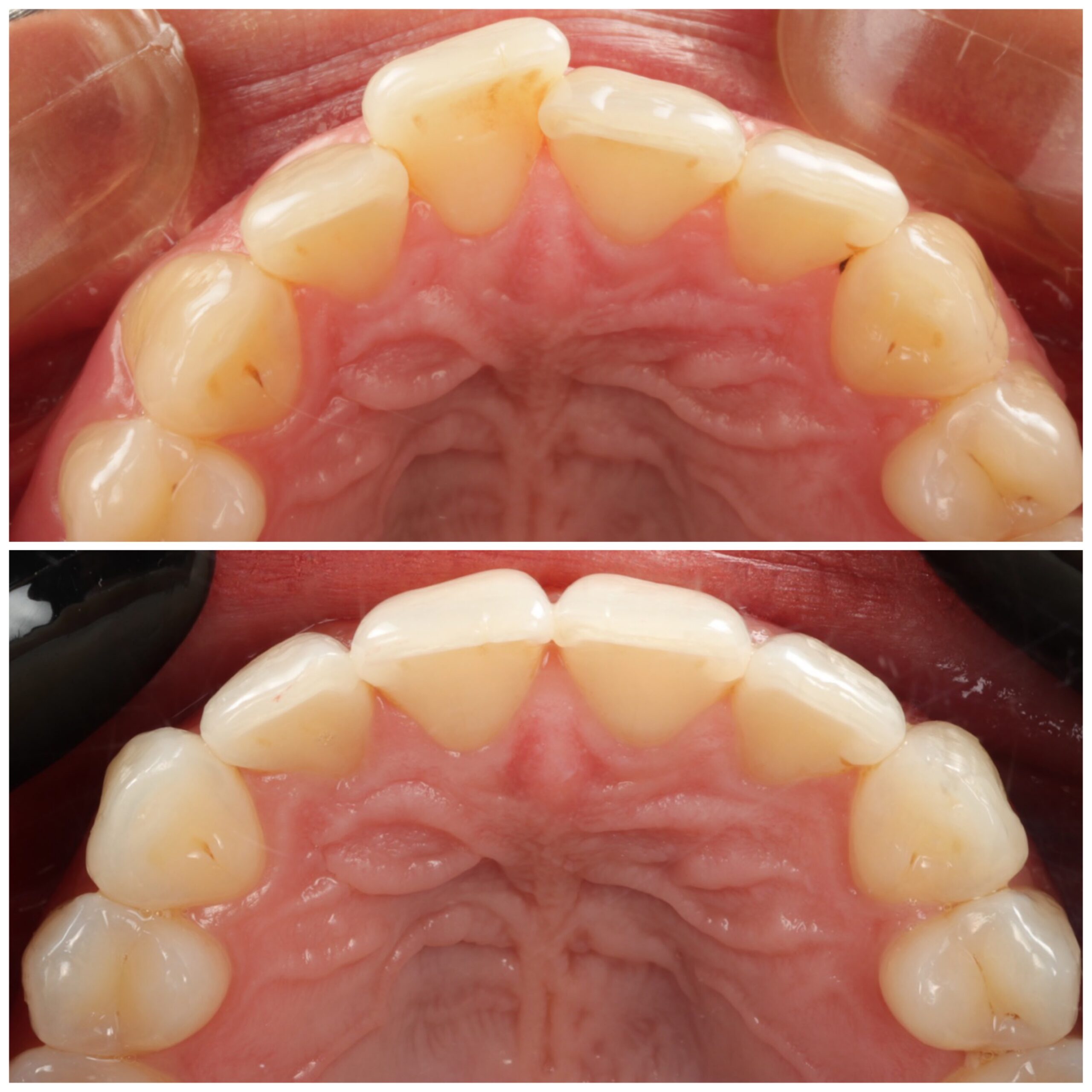 Smile-gallery-harrow