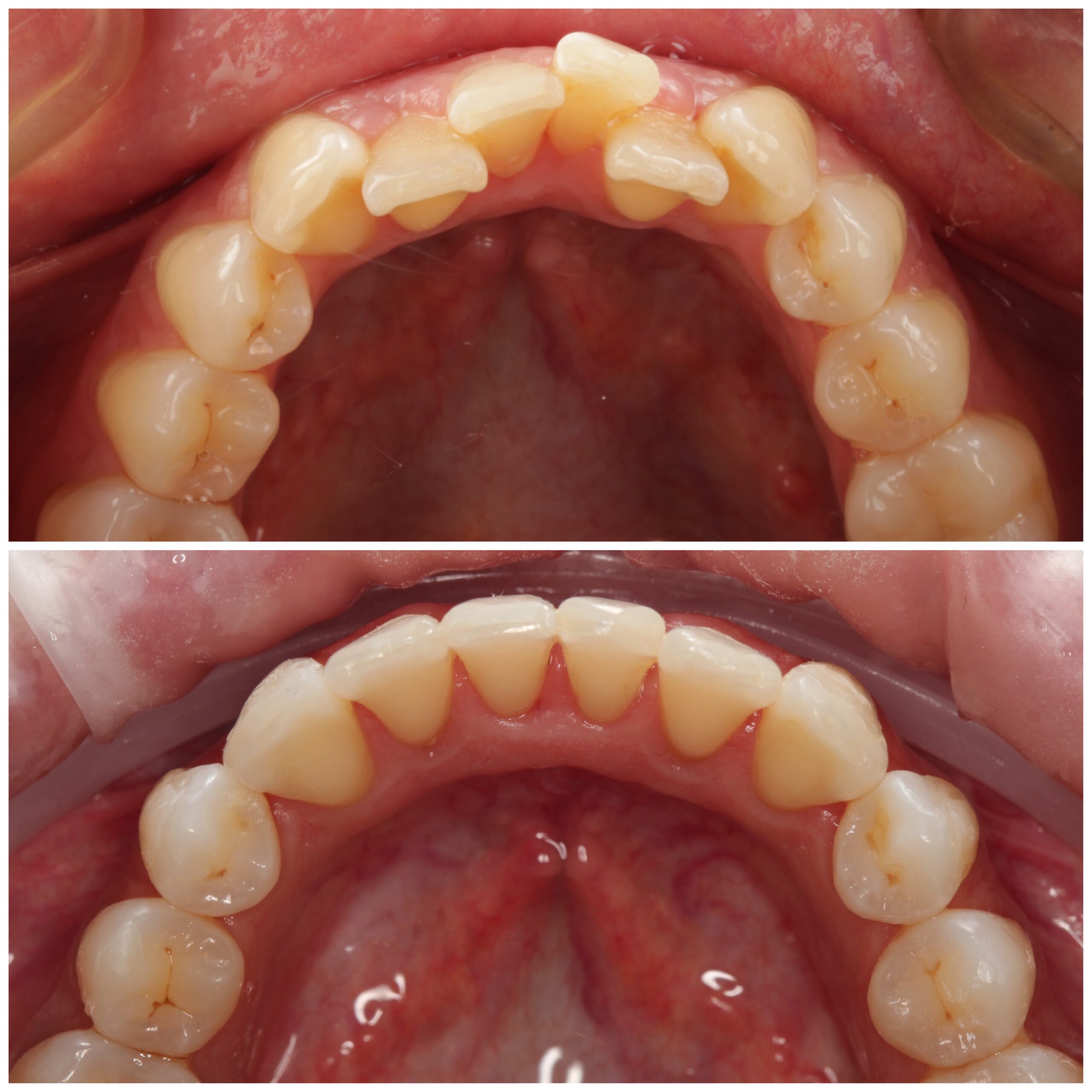 Smile-gallery-harrow