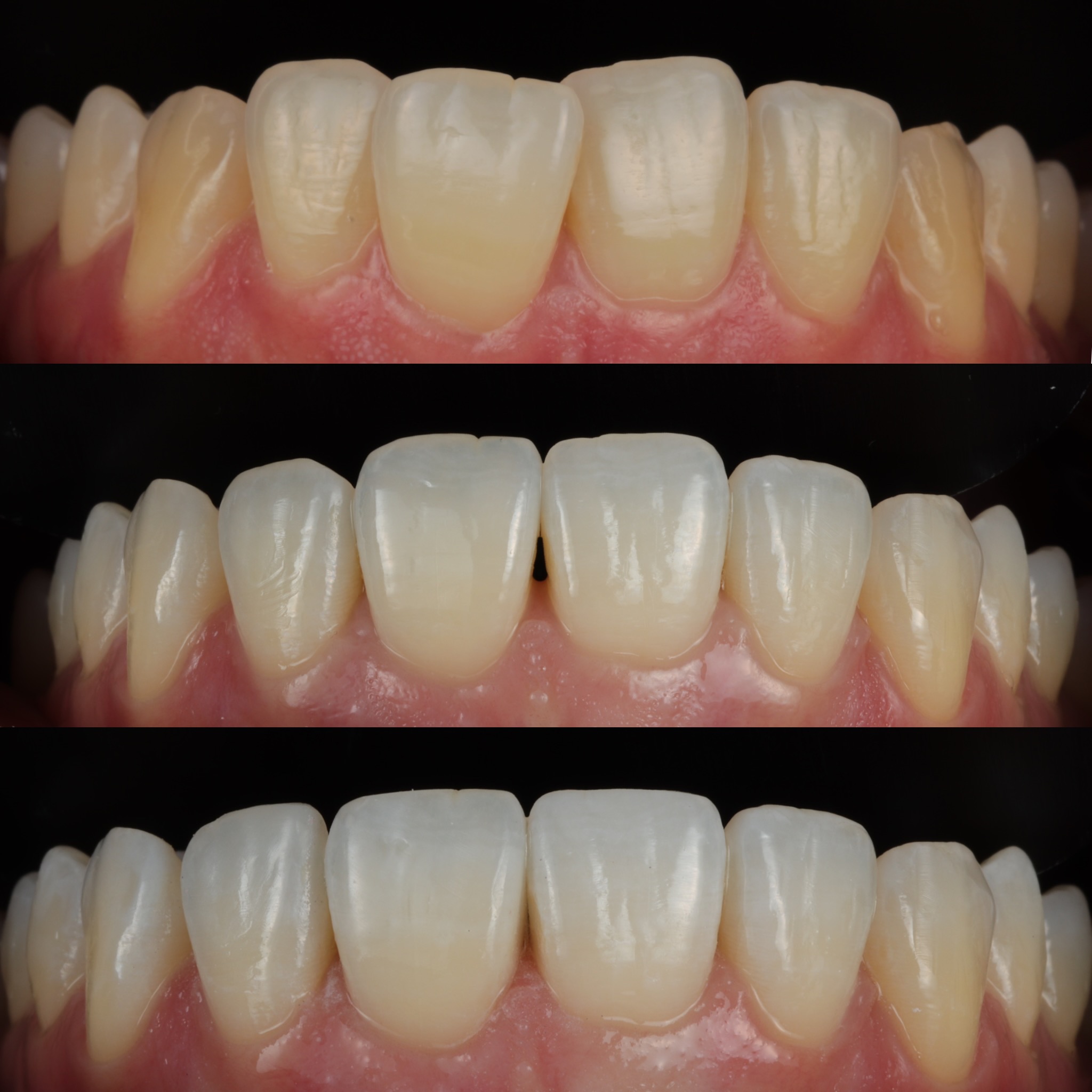 Smile-gallery-harrow