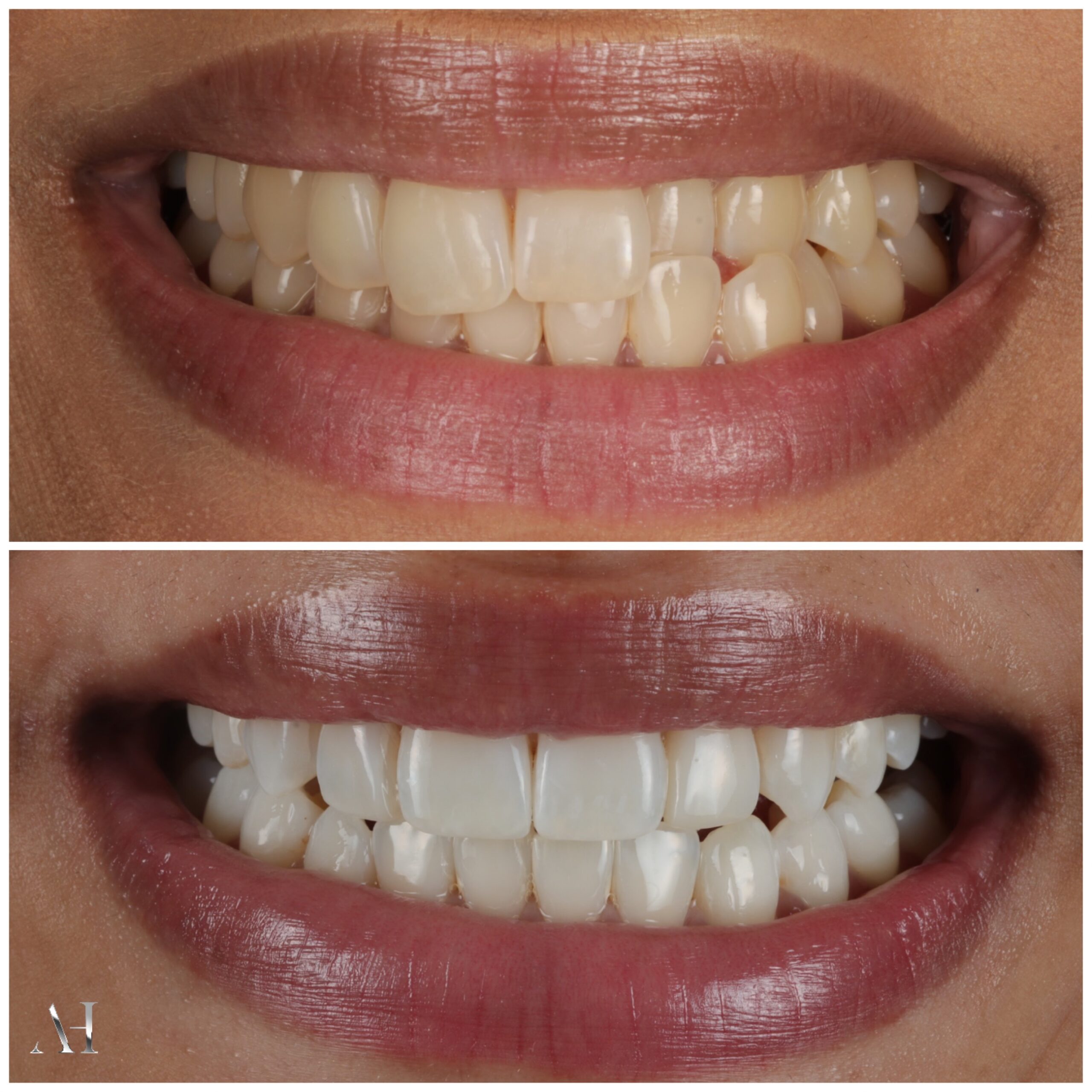 Smile-gallery-harrow
