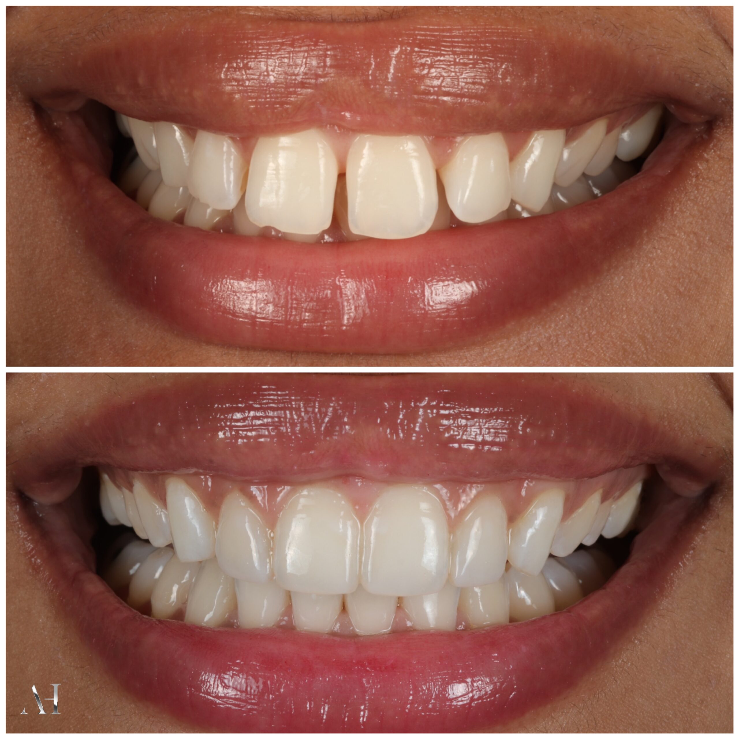 Smile-gallery-harrow