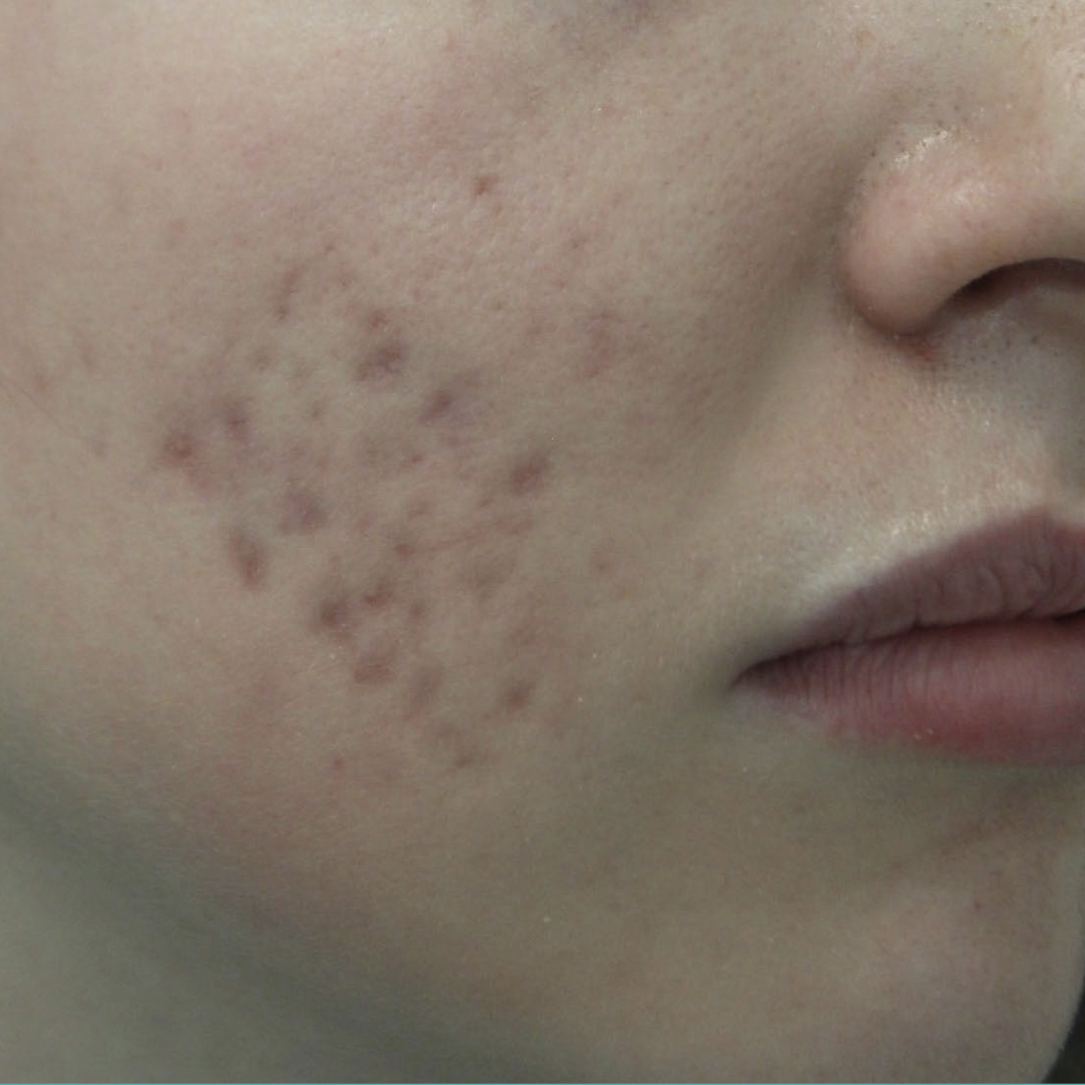 before-treatment-image