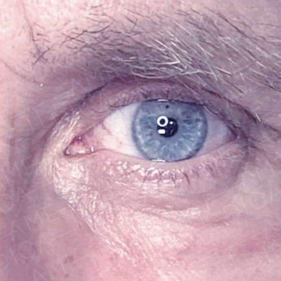 after-treatment-image