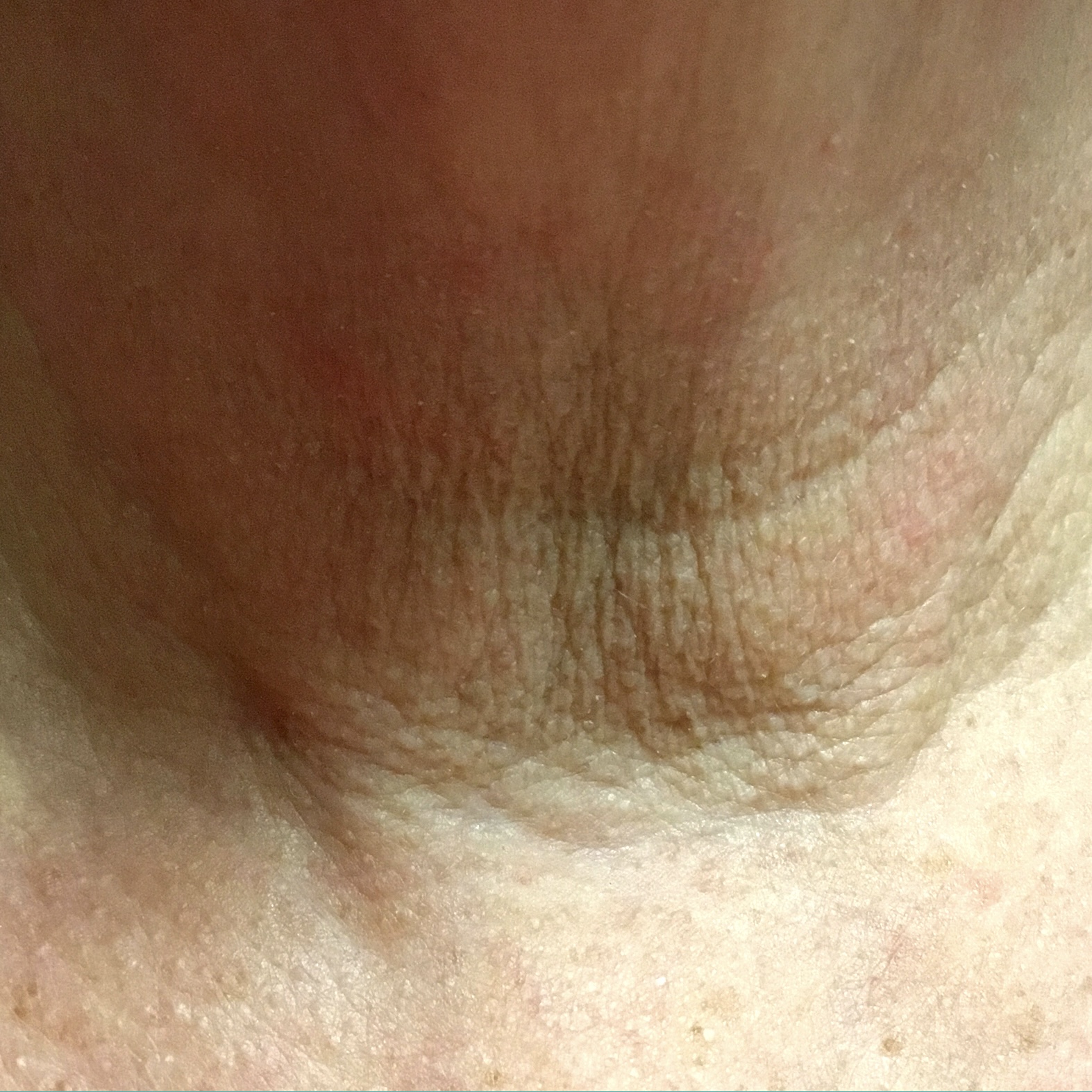 before-treatment-image