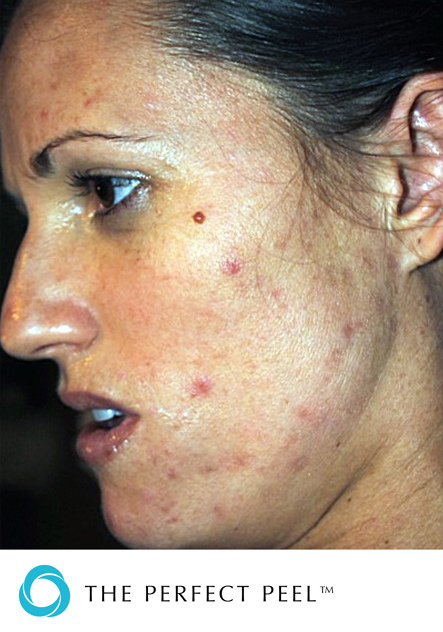 before-treatment-image