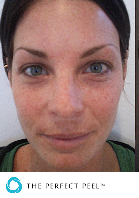 before-treatment-image