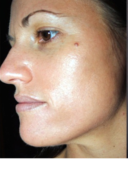 after-treatment-image