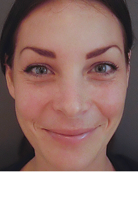 after-treatment-image