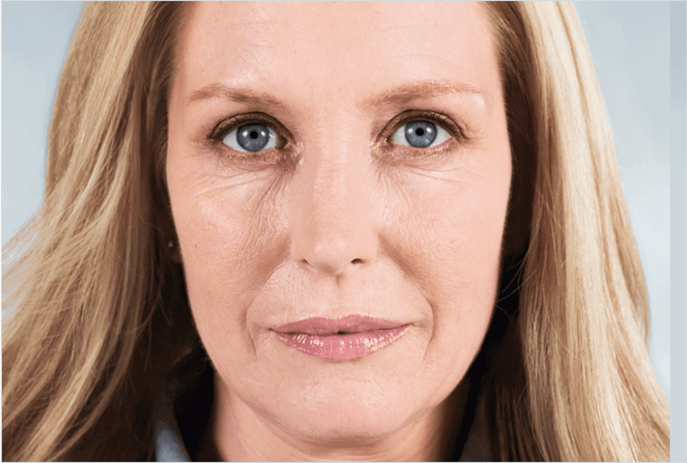 before-treatment-image