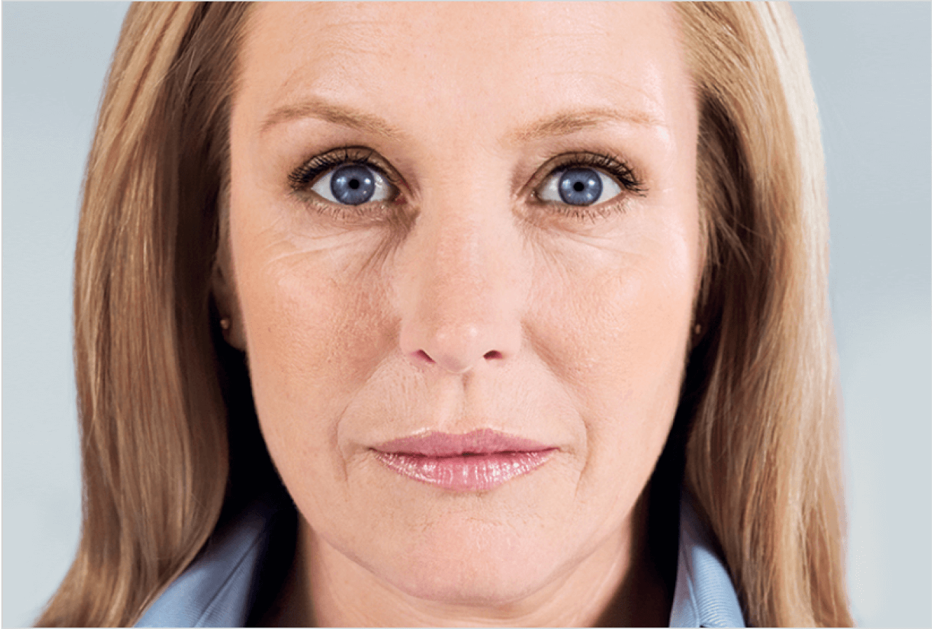 after-treatment-image