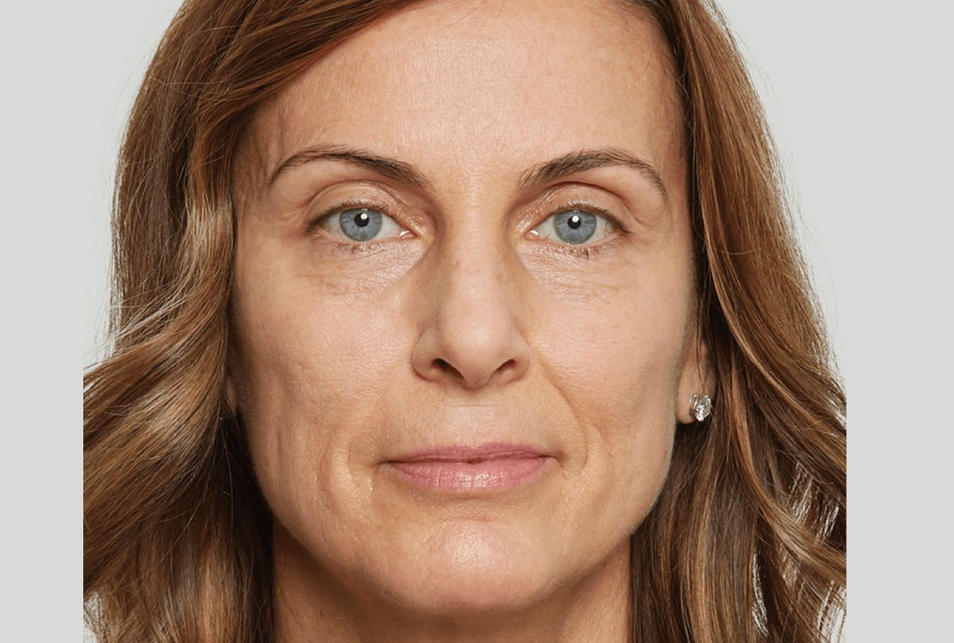before-treatment-image